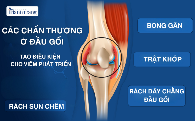 Cac chan thuong tao dieu kien cho viem khop dau goi phat trien